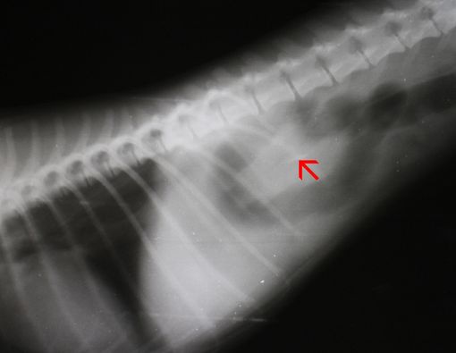 Sering Dikira Susuk, Benda Asing di Tubuh Bisa Jadi Corpus Alienum!