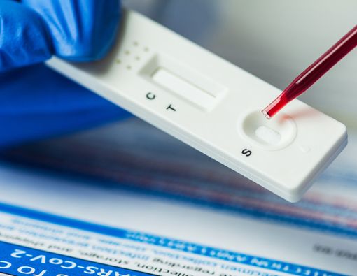 Rapid Test vs Serologi untuk Deteksi Corona, Mana Lebih Akurat?