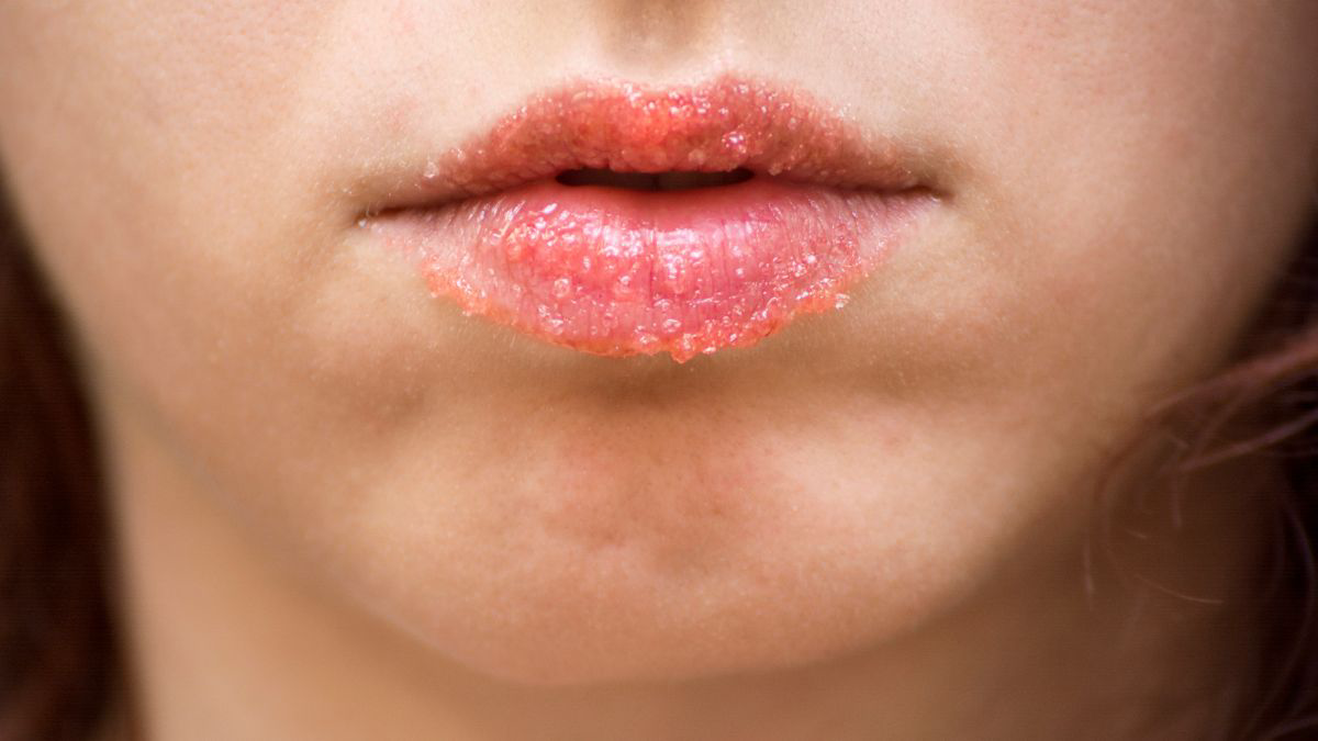 Cara Membuat Masker Bibir