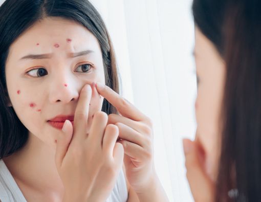 Tidak Cuci Muka Seharian, Ini Efeknya untuk Kesehatan!