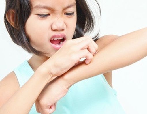 Menangani Alergi Makanan Pada Anak