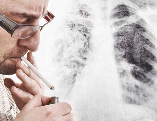 Awas, Rokok Bisa Membuat Paru-Paru Anda seperti Ini