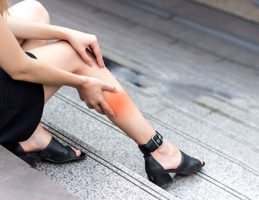 Kenali Gejala DVT yang Mengancam Nyawa