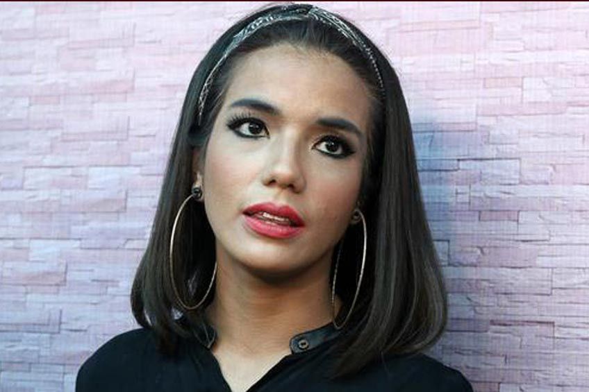 Alami Kecelakaan, Sheila Marcia Akan Menjalani Operasi