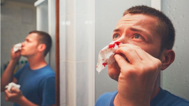 Tips Hentikan Mimisan atau Hidung Berdarah dengan Efektif
