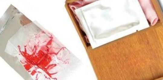 Risiko Selaput Dara Tiruan