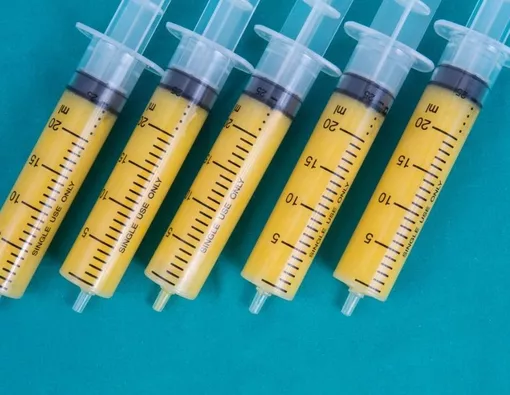 Apa Fat Transfer Lebih Aman dari Filler Payudara?