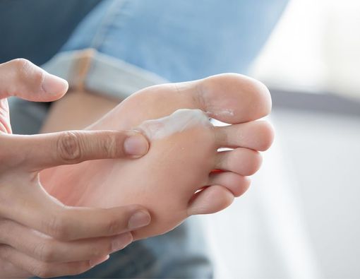 5 Cara Ampuh Menghilangkan Kulit Gatal Berair