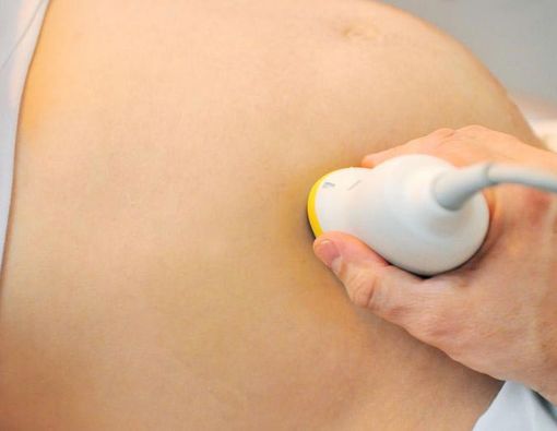 Mitos dan Fakta Menebak Jenis Kelamin Janin