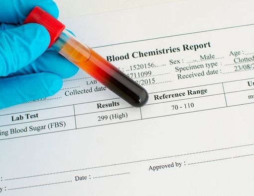 Waspada, Asupan Gula Tinggi Dapat Memicu Kanker Paru