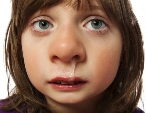 Tips Atasi Alergi Pada Hidung