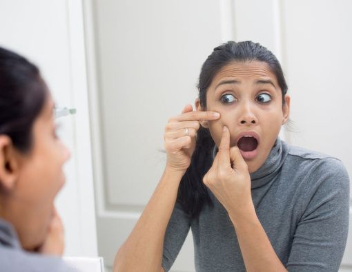 Kiat Agar Jerawat Tak Semakin Gawat