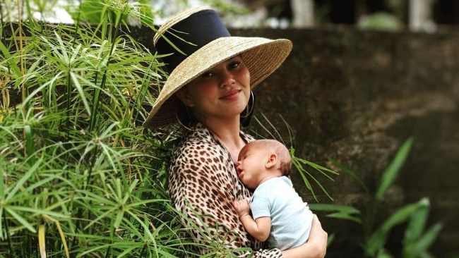 Kenali Gejala Plagiocephaly seperti Anak Chrissy Teigen