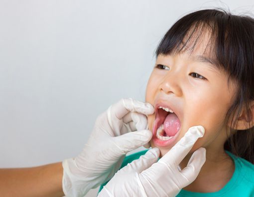 Waspada, Polio Bisa Berdampak pada Kesehatan Gigi dan Mulut