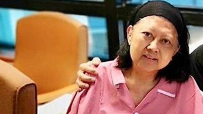 Efek Kemoterapi pada Wajah seperti Dialami Ibu Ani Yudhoyono