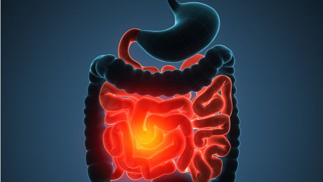 Makanan Sehat Ini Efektif Mencegah Kanker Usus