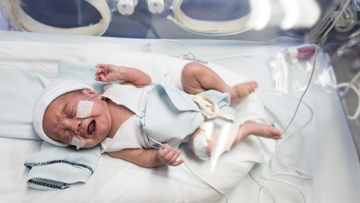 Alasan Bayi Harus Dirawat di NICU