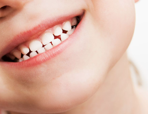 Tips Merawat Gigi Susu Anak