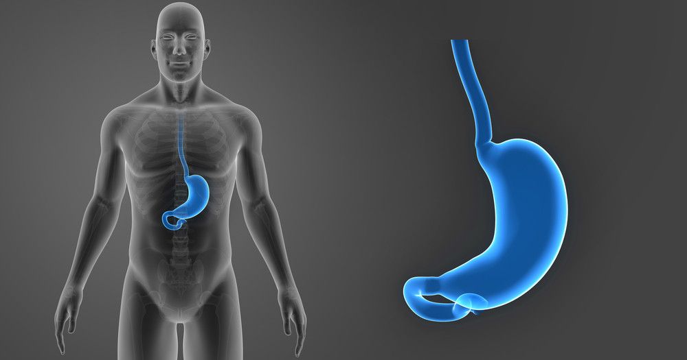 Pengecilan Lambung, Solusi bagi Kasus Obesitas Wanita 350 kg?