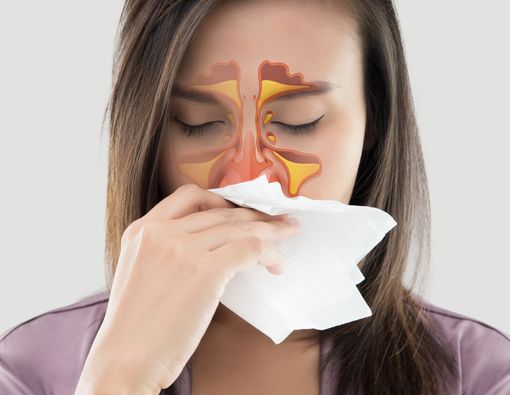 Efektivitas Terapi Gurah untuk Atasi Sinusitis