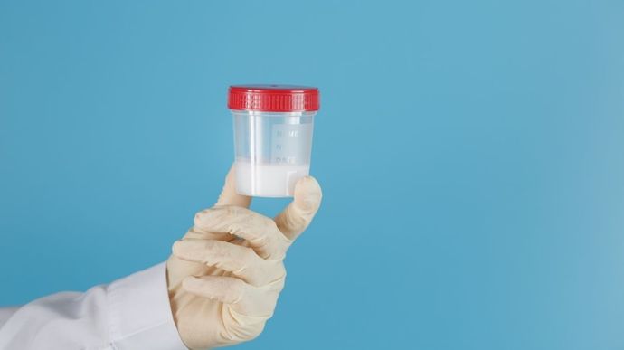 Scholnitz bilan jinsiy aloqa