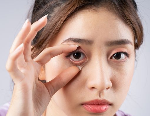 Apa Itu Mata Malas? Ini Penyebab dan Cara Mengatasinya