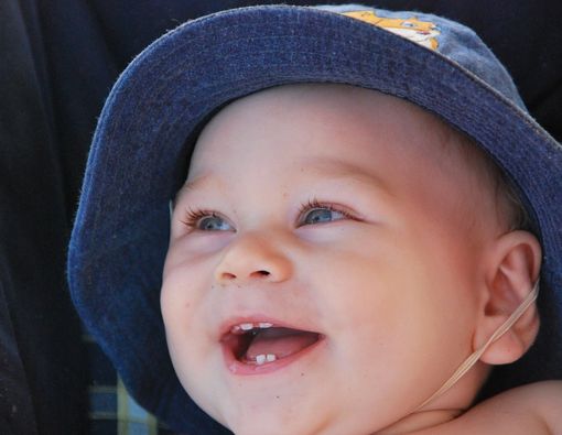 Gigi Bayi Tidak Rata, Ini Penyebab dan Cara Atasinya!