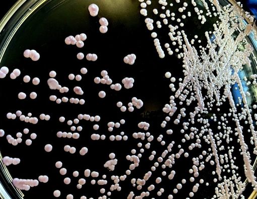 Mengenal Infeksi Jamur Putih yang Menyerang Pasien COVID-19 India