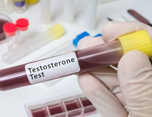 Apa Jadinya Jika Wanita Tidak Punya Hormon Testosteron?