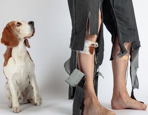 Terkena Gigitan Anjing? Lakukan 3 Hal Ini untuk Menghindari Rabies