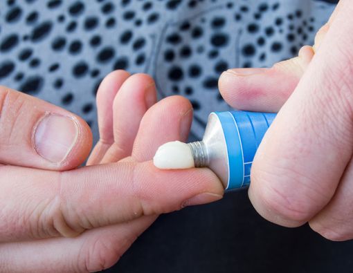 Benarkah Obat Bius Topikal Bikin Tubuh Membiru?