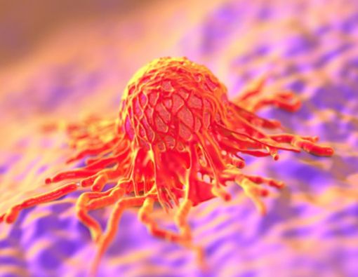 Keputihan Tak Kunjung Sembuh, Waspadai Gejala Kanker Serviks