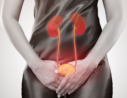 Infeksi Kandung Kemih