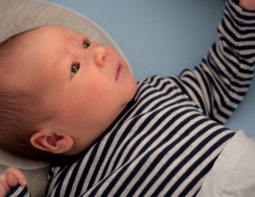 Kepala Peyang pada Bayi, Bisa Diperbaiki?