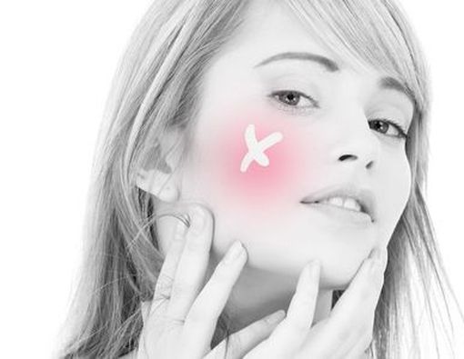 Penyebab Iritasi pada Kulit