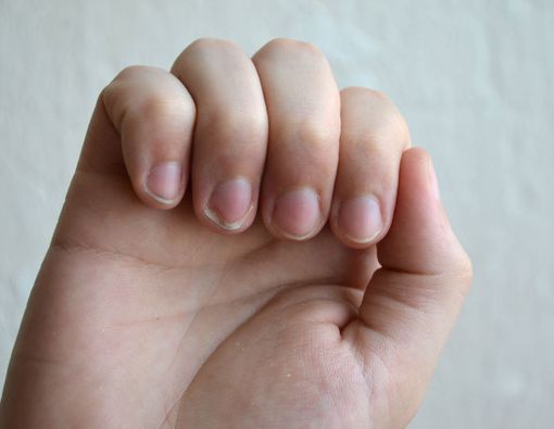 Cek Kesehatan Tubuh Anda Lewat Kuku