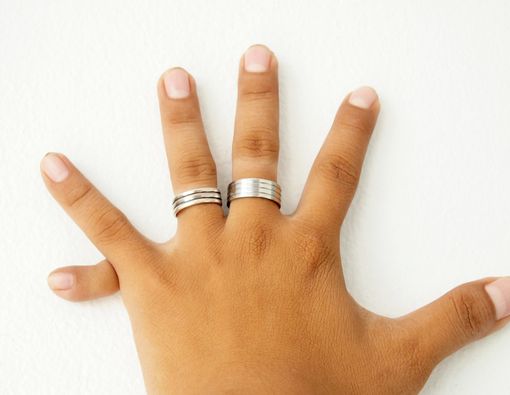 Polidaktili, Kelainan yang Membuat Seseorang Punya Jari Tambahan