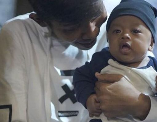 Penyebab Sindrom Williams yang Dialami Anak Dede Sunandar