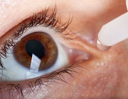 Penyebab dan Solusi Mata Kering