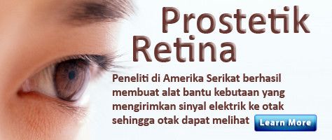 Prostetik Pengganti Fungsi Retina