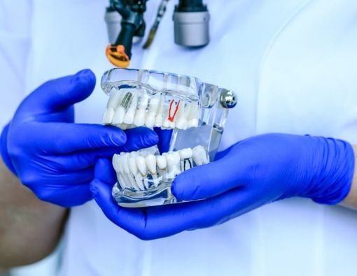 Mengenal Dokter Spesialis Konservasi Gigi atau Endodontist