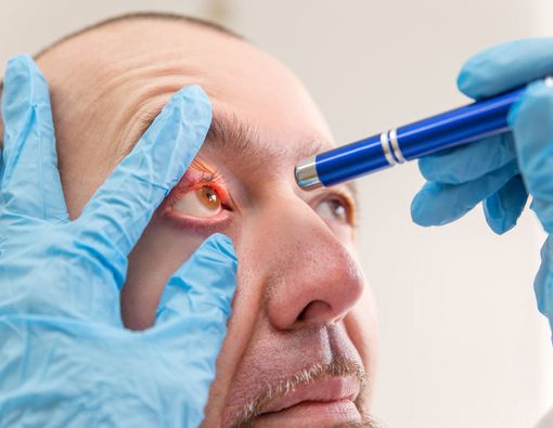 4 Cara Cepat dan Mudah Atasi Bintitan