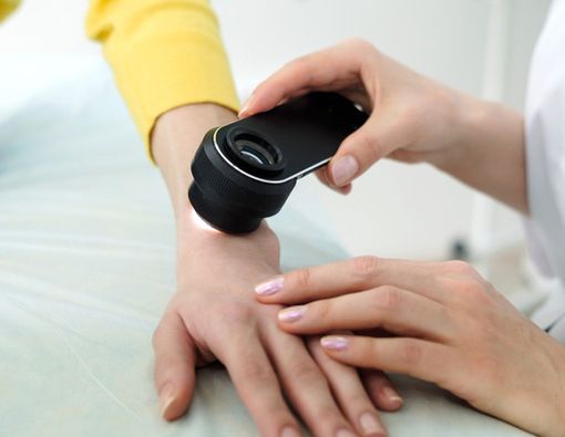 Ini Dia Penyakit yang Ditangani Dokter Spesialis Kulit dan Kelamin!