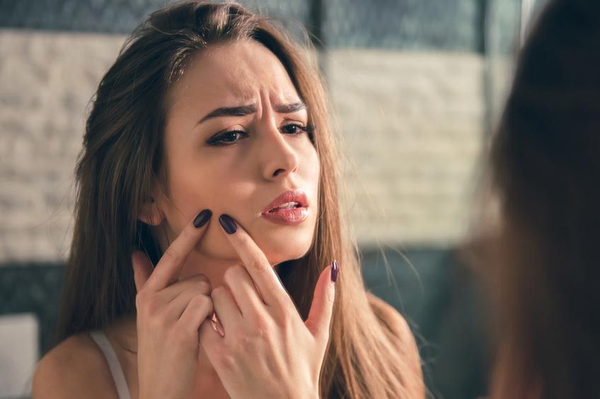 Cara Mudah Lenyapkan Bekas Jerawat