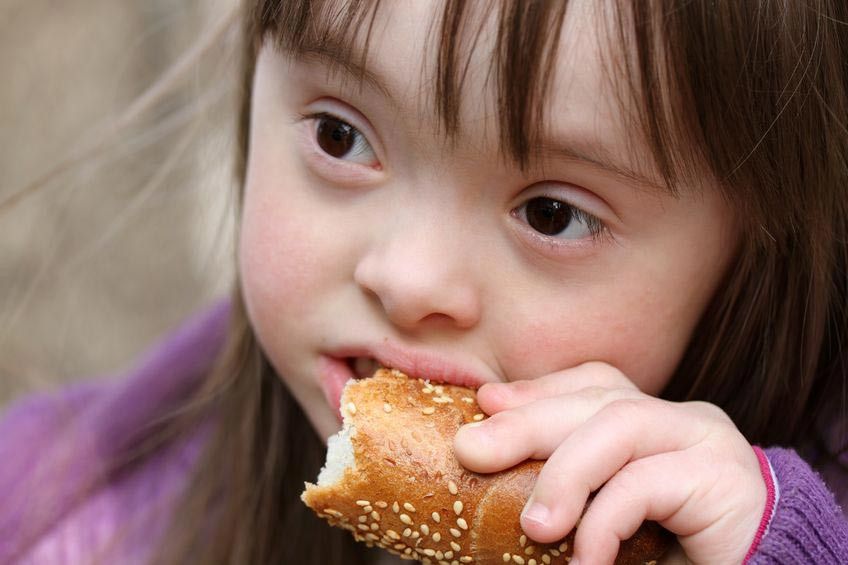 Asupan Gizi untuk Anak Sindrom Down