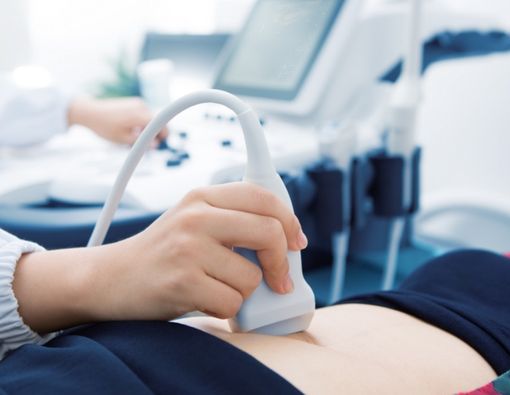  7 Jenis Tes Kesuburan Wanita dalam Program Hamil