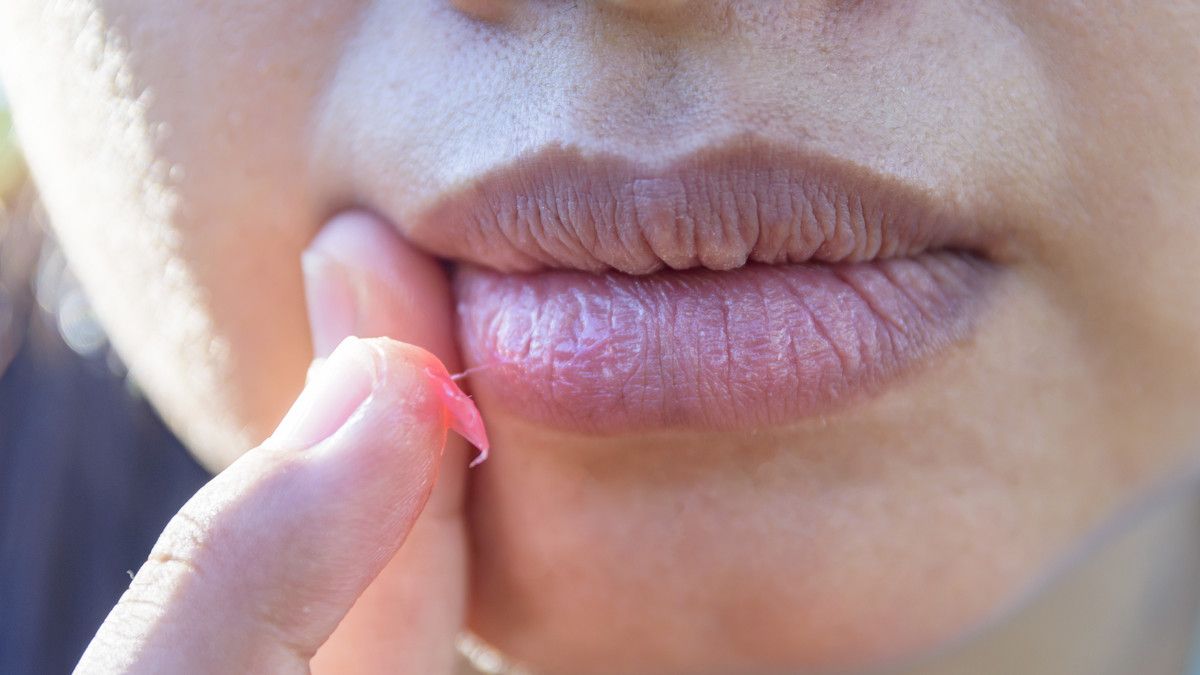 Cara Alami Mengatasi Mulut Kering (Werayuth Tes/Shutterstock)