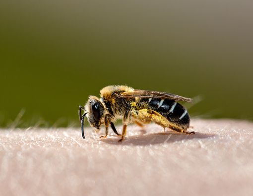 7 Pertolongan Pertama Setelah Disengat Lebah