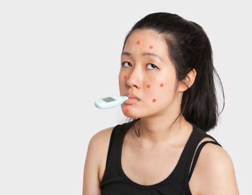 10 Cara Menghilangkan Bopeng Bekas Cacar Air Secara Alami dan Medis