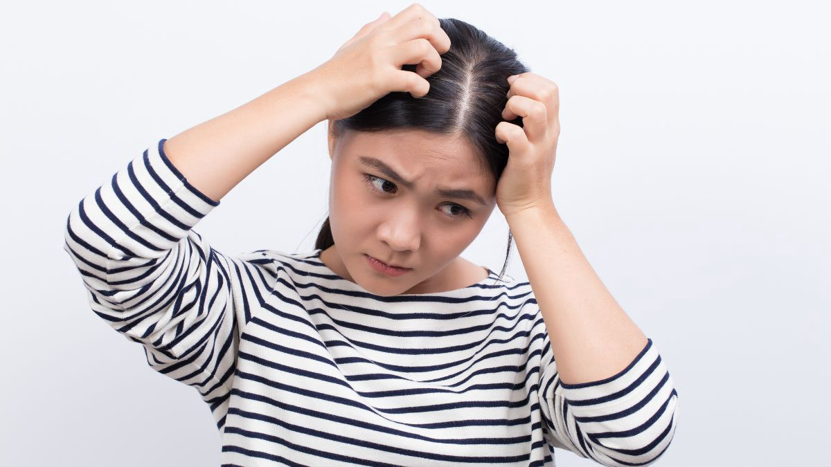 Daftar Obat Penghilang Kutu Rambut yang Ampuh